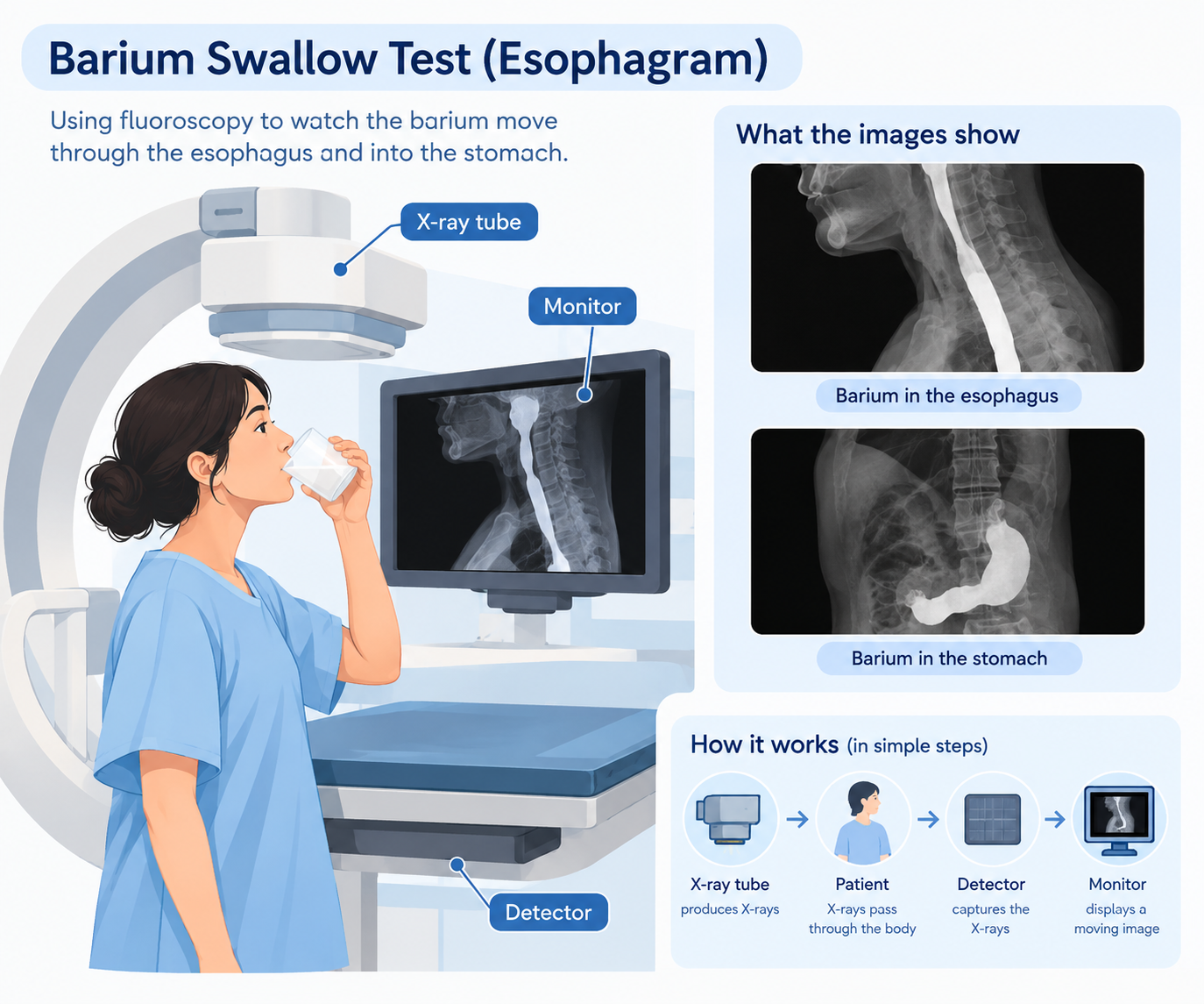 Barium swallow fluoroscopy