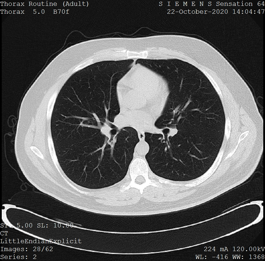 Example of a CT cross-sectional image