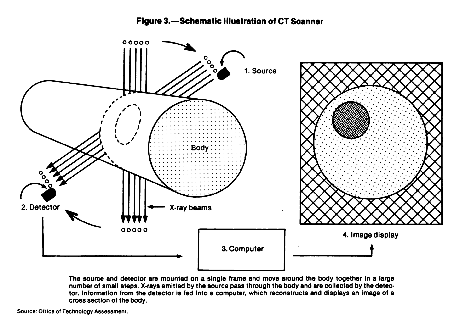 Schematic illustration showing the basic working principle of computed tomography