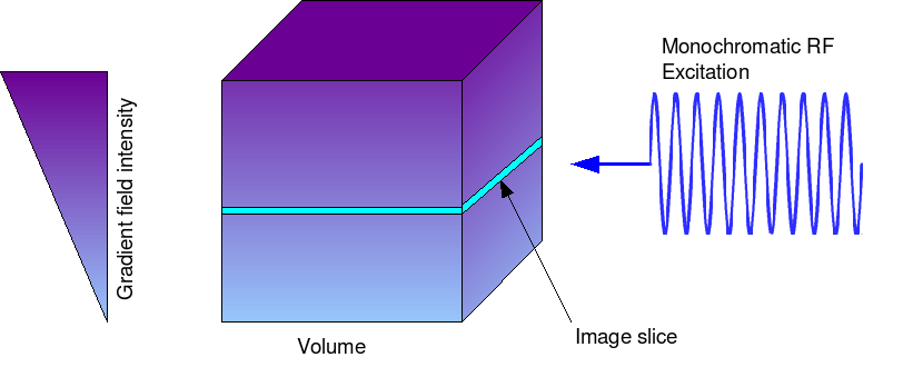 Illustration showing MRI slice selection using a magnetic field gradient