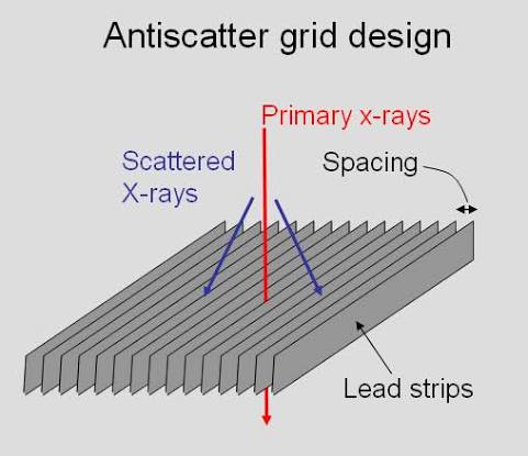 Diagram showing the use of an anti-scatter grid in X-ray imaging