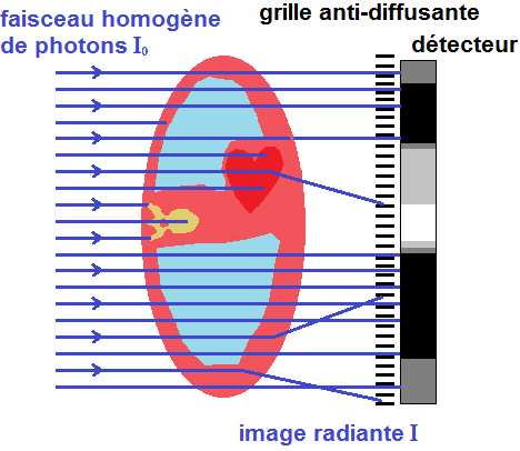 Diagram showing differential attenuation of X-rays through different tissues
